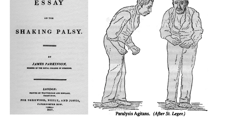 Titelsidan på boken "An Essay On The Shaking Palsy" och en illustration av en parkinsonpatient